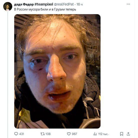 Скриншот твита «дядя Фёдор #teampixel @realFedPat · 16 ч»: «В России мусора били и в Грузии теперь». Фото: крупным планом лицо молодого мужчины (светлые волосы) — под правым глазом синяк, на губе запёкшаяся кровь, взгляд прямой. Тёмный фон, уличная одежда. Статистика: 431 комментарий, 108 ретвитов, 967 лайков, 112 тыс. просмотров.